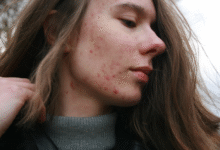 Effective Approaches to Managing Chronic Skin Conditions