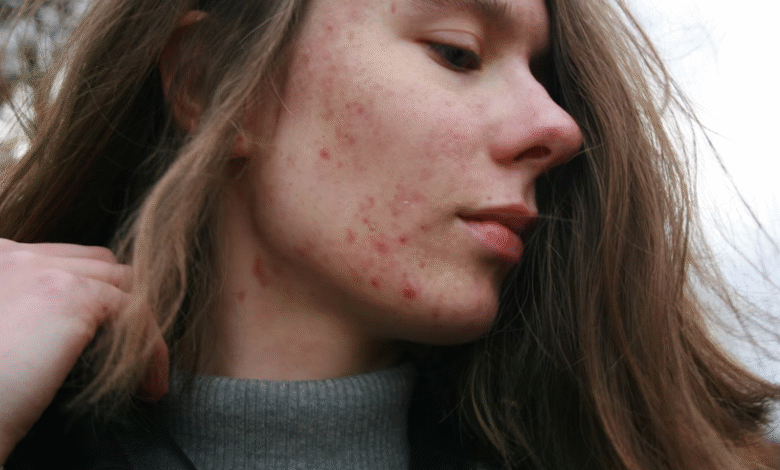 Effective Approaches to Managing Chronic Skin Conditions